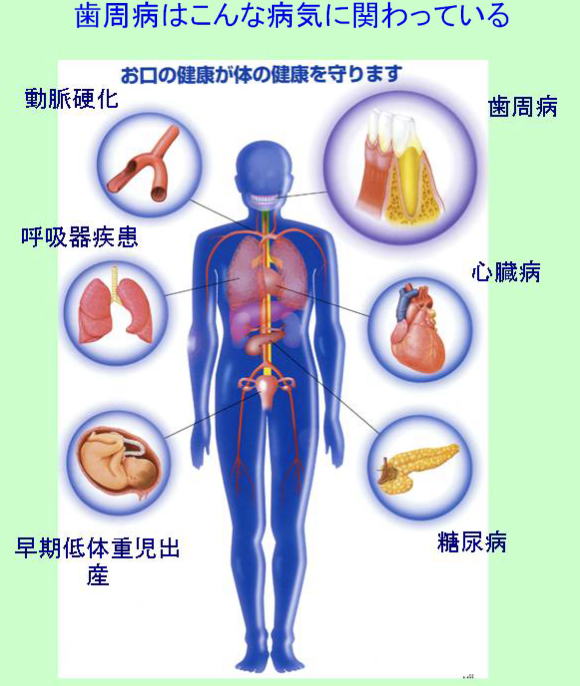 歯周病が関わる疾患 動脈硬化・呼吸器疾患・歯周病・心臓病・糖尿病・早期低体重児出産